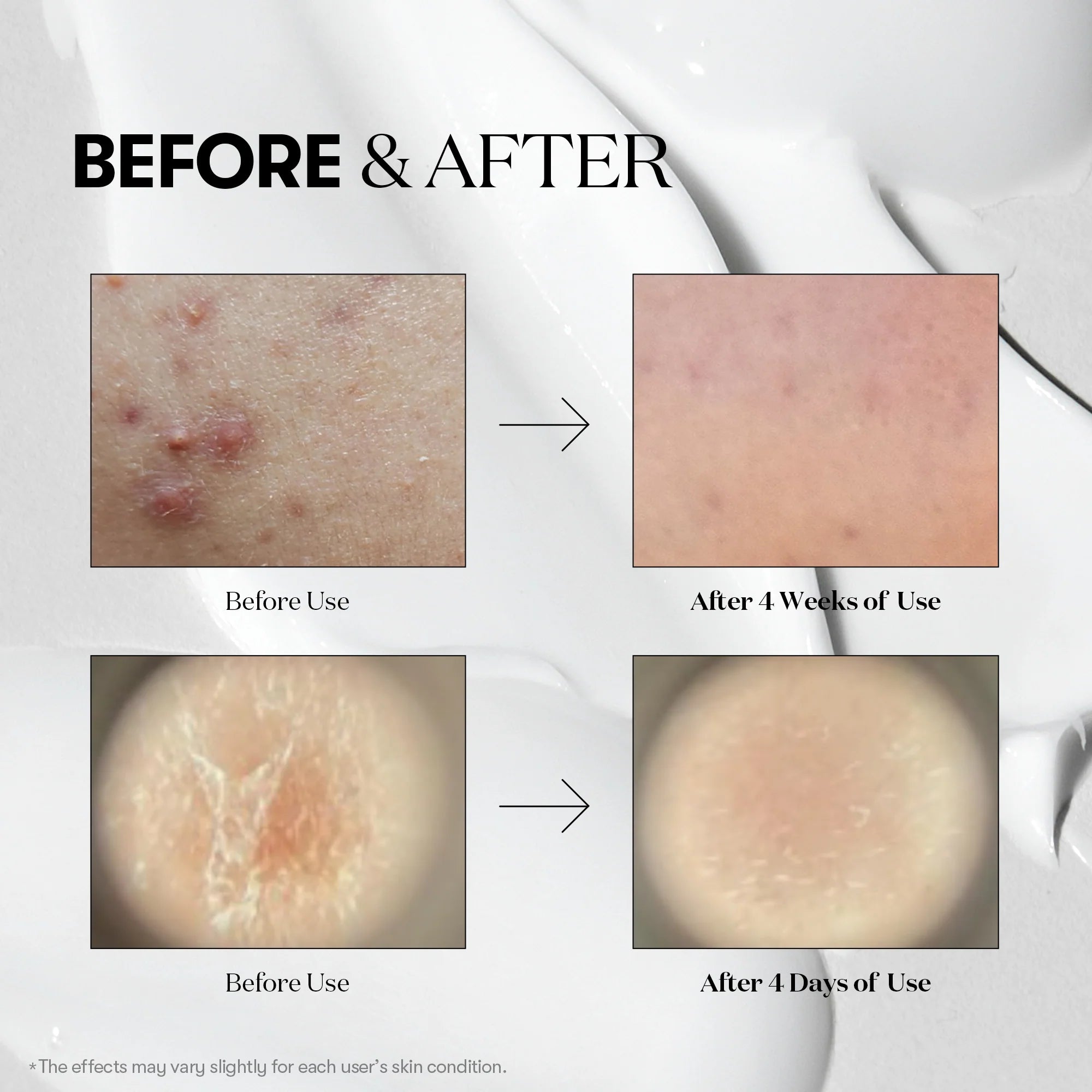 VT Cosmetics - Reedle Shot 700