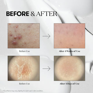 VT Cosmetics - Reedle Shot 700